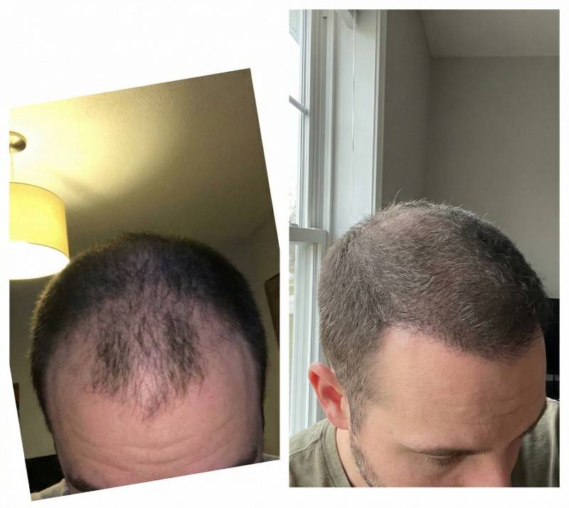 Customer visible progress comparison